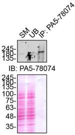 NEK1 Antibody in Immunoprecipitation (IP)