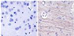 NEFL Antibody in Immunohistochemistry (Paraffin) (IHC (P))