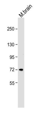 NEFL Antibody in Western Blot (WB)