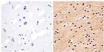 NEFM Antibody in Immunohistochemistry (Paraffin) (IHC (P))