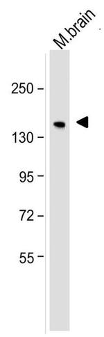 NEFM Antibody in Western Blot (WB)