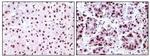 NPM1 Antibody in Immunohistochemistry (Paraffin) (IHC (P))