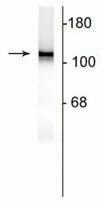 NMDAR1 Antibody in Western Blot (WB)