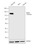 NEFM Antibody in Western Blot (WB)