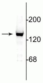 NMDAR2C Antibody in Western Blot (WB)