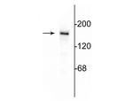 NMDAR2B Antibody in Western Blot (WB)