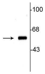 Tyrosine Hydroxylase Antibody in Western Blot (WB)