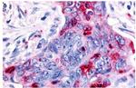 RON Antibody in Immunohistochemistry (Paraffin) (IHC (P))