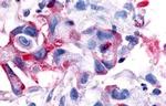 RON Antibody in Immunohistochemistry (Paraffin) (IHC (P))