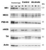 NMDAR2C Antibody in Western Blot (WB)