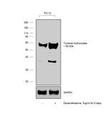 Tyrosine Hydroxylase Antibody in Western Blot (WB)