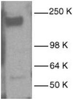 EGFR Antibody in Western Blot (WB)