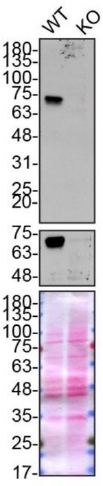 Optineurin Antibody in Western Blot (WB)