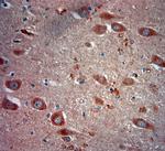 ATG10 Antibody in Immunohistochemistry (Paraffin) (IHC (P))