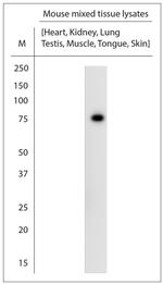 ATG7 Antibody in Western Blot (WB)