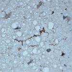 ATG16L1 Antibody in Immunohistochemistry (Paraffin) (IHC (P))