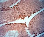 AQP2 Antibody in Immunohistochemistry (Paraffin) (IHC (P))