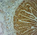 AQP10 Antibody in Immunohistochemistry (Paraffin) (IHC (P))