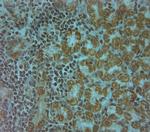 AQP10 Antibody in Immunohistochemistry (Paraffin) (IHC (P))