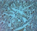 AQP9 Antibody in Immunohistochemistry (IHC)