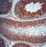 Artemin Antibody in Immunohistochemistry (Paraffin) (IHC (P))