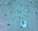 AQP11 Antibody in Immunohistochemistry (Paraffin) (IHC (P))