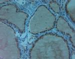 AQP11 Antibody in Immunohistochemistry (Paraffin) (IHC (P))