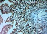 ATP8B1 Antibody in Immunohistochemistry (Paraffin) (IHC (P))