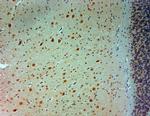 ARX Antibody in Immunohistochemistry (Paraffin) (IHC (P))