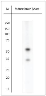 ARX Antibody in Western Blot (WB)