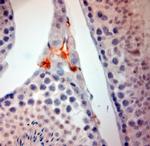 ACE2 Antibody in Immunohistochemistry (Paraffin) (IHC (P))