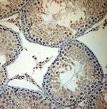 ACE2 Antibody in Immunohistochemistry (Paraffin) (IHC (P))