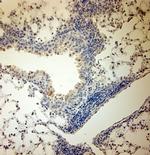 ACE2 Antibody in Immunohistochemistry (Paraffin) (IHC (P))