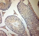 ACE2 Antibody in Immunohistochemistry (Paraffin) (IHC (P))