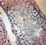 ACE2 Antibody in Immunohistochemistry (Paraffin) (IHC (P))