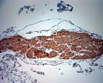 BDKRB2 Antibody in Immunohistochemistry (Paraffin) (IHC (P))