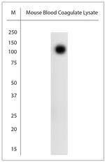 SLC4A1 Antibody in Western Blot (WB)