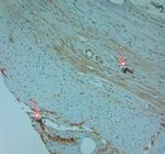 LL-37 Antibody in Immunohistochemistry (Paraffin) (IHC (P))