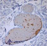 LL-37 Antibody in Immunohistochemistry (Paraffin) (IHC (P))