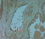 LL-37 Antibody in Immunohistochemistry (Paraffin) (IHC (P))