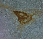 LL-37 Antibody in Immunohistochemistry (Paraffin) (IHC (P))