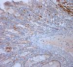 LL-37 Antibody in Immunohistochemistry (Paraffin) (IHC (P))