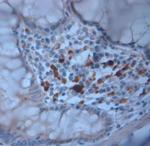 LL-37 Antibody in Immunohistochemistry (Paraffin) (IHC (P))