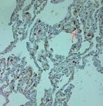 LL-37 Antibody in Immunohistochemistry (Paraffin) (IHC (P))