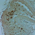 LL-37 Antibody in Immunohistochemistry (Paraffin) (IHC (P))