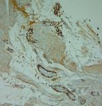 LL-37 Antibody in Immunohistochemistry (Paraffin) (IHC (P))