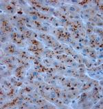 LL-37 Antibody in Immunohistochemistry (Paraffin) (IHC (P))