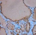 LL-37 Antibody in Immunohistochemistry (Paraffin) (IHC (P))