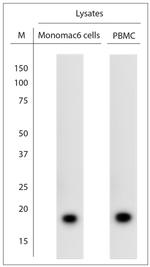 LL-37 Antibody in Western Blot (WB)