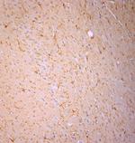 Cofilin 1 Antibody in Immunohistochemistry (Paraffin) (IHC (P))